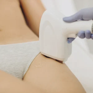 Brazilian Extended Laser Hair Removal