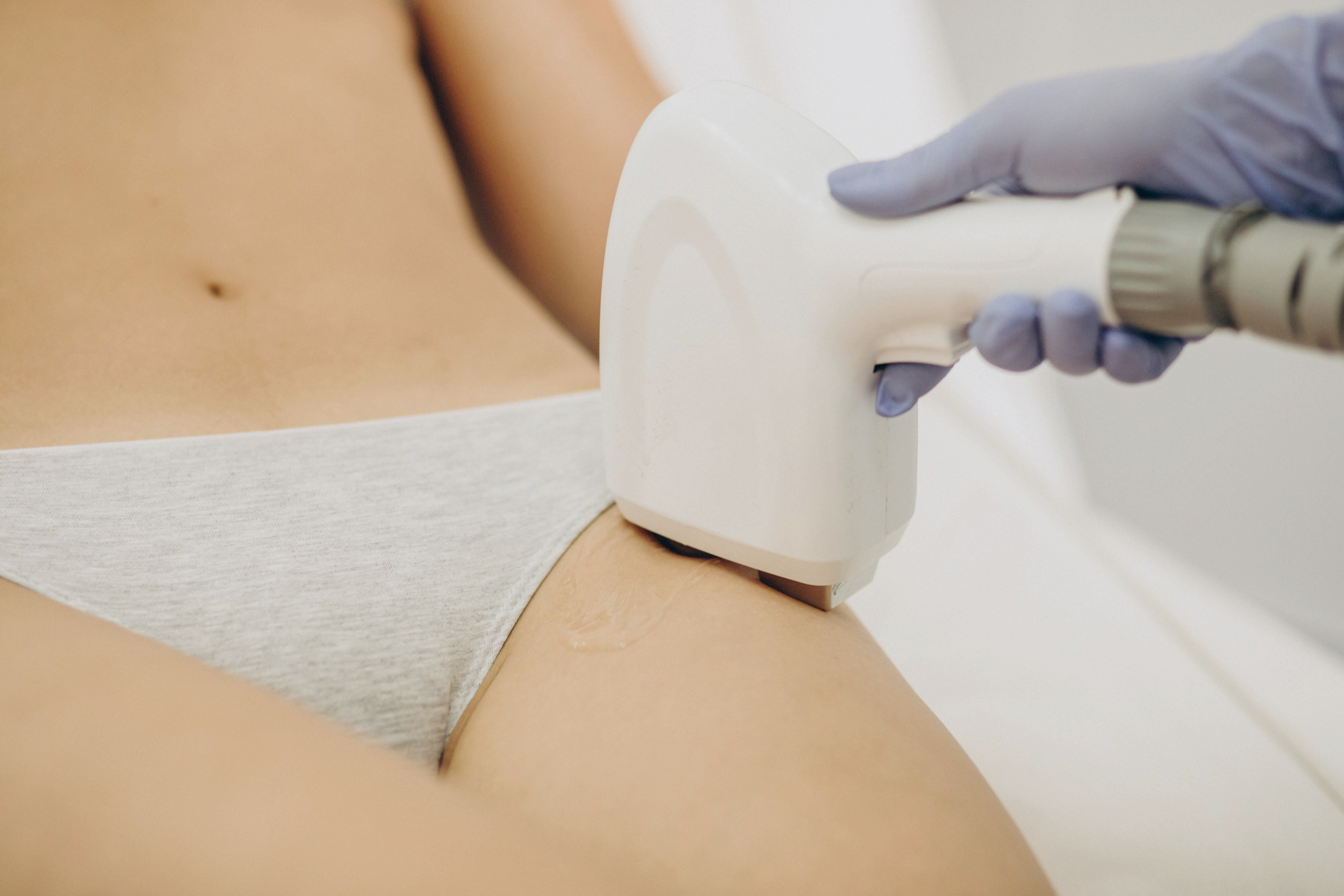 Brazilian Extended Laser Hair Removal