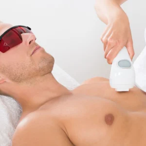 Chest Laser Hair Removal