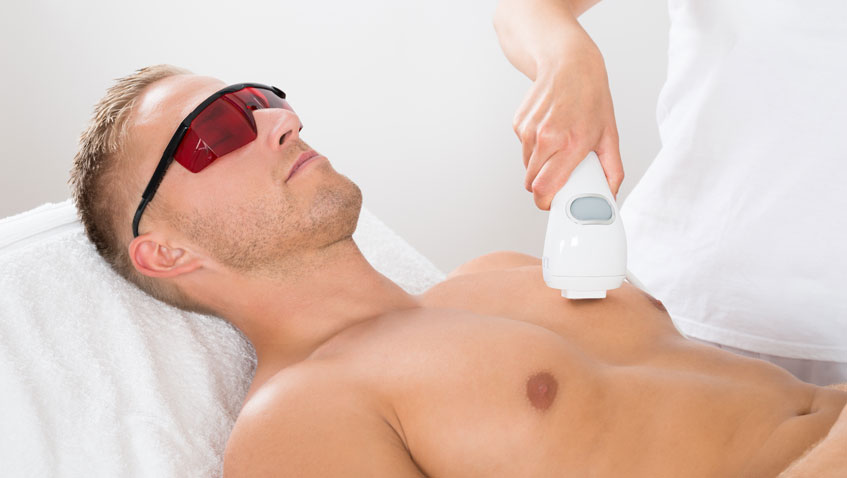 Chest Laser Hair Removal