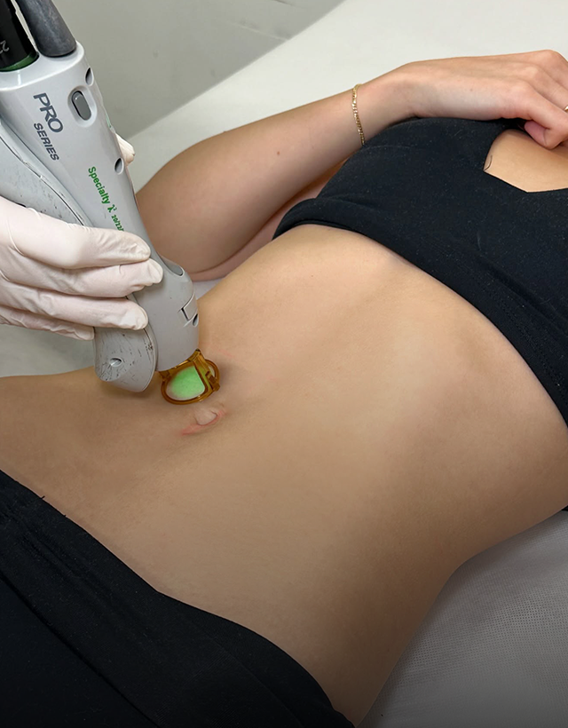 Laser Hair Removal Pelham Bay Bronx