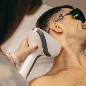 Laser Hair Removal Back of Neck