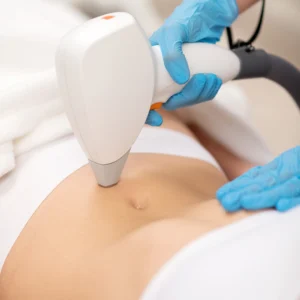 Laser Touch-up Medium Area