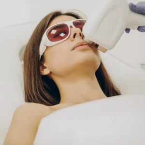 Laser Touch-up Small Area