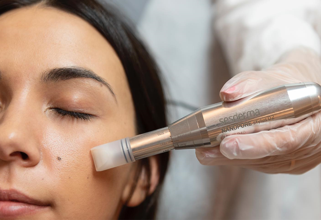 Nanopore Micro-Needling for Scars