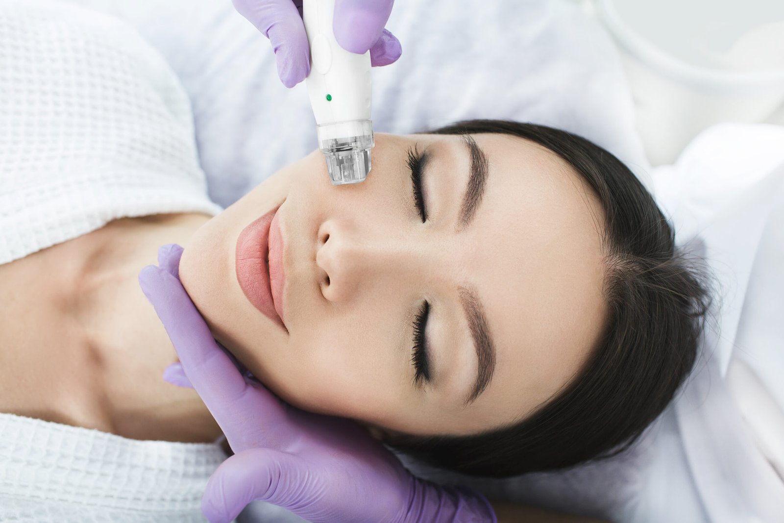 Potenza microneedling Pelham Parkway