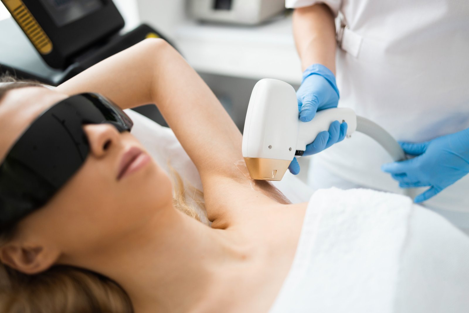laser hair removal dark skin
