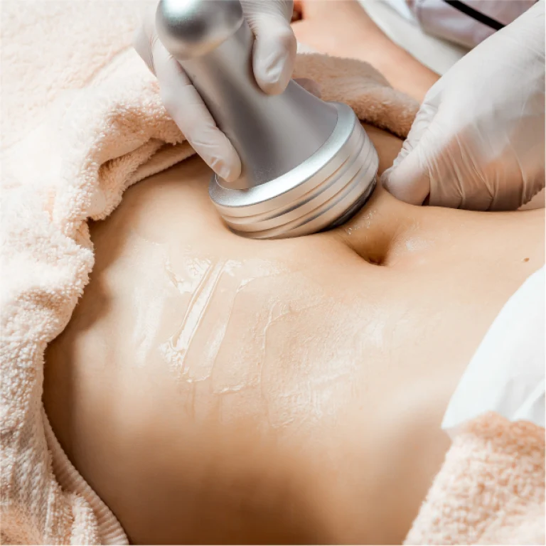 POST-OPERATIVE copia