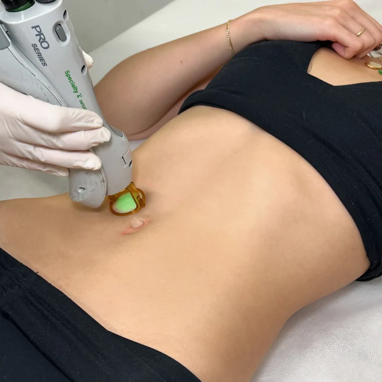 Stomach Laser